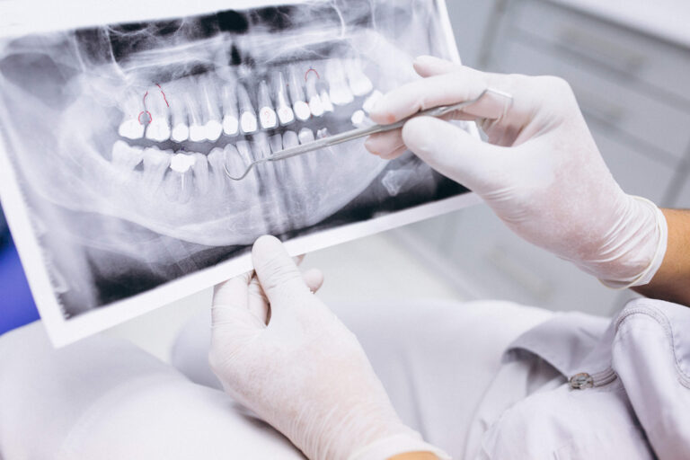X ray of teeth
